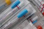 «Минздрав Турции не разглашает критерии тестирования на коронавирус»