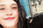 В Турции девушка, простила бывшего парня, облившего её кислотой