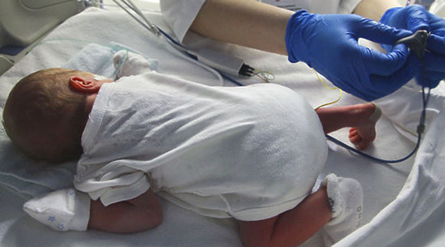 Турецкие врачи спасли 600-граммового новорожденного