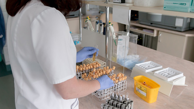 «Контроль Турции над тестовыми наборами на коронавирус усиливает опасения по поводу сокрытия информации»